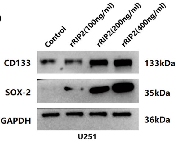 U251 cells were treated with rRIP2.jpg